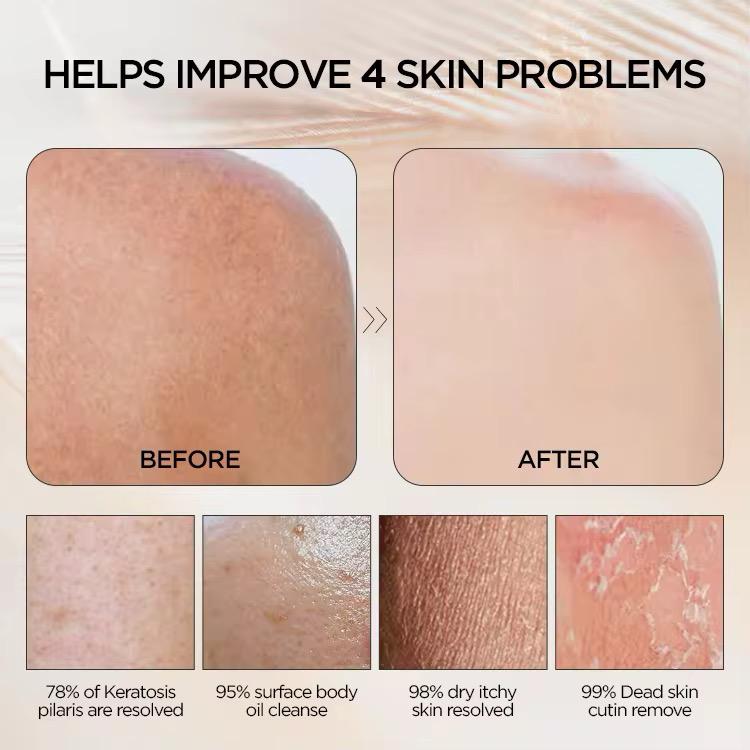 Gant anti-peau morte