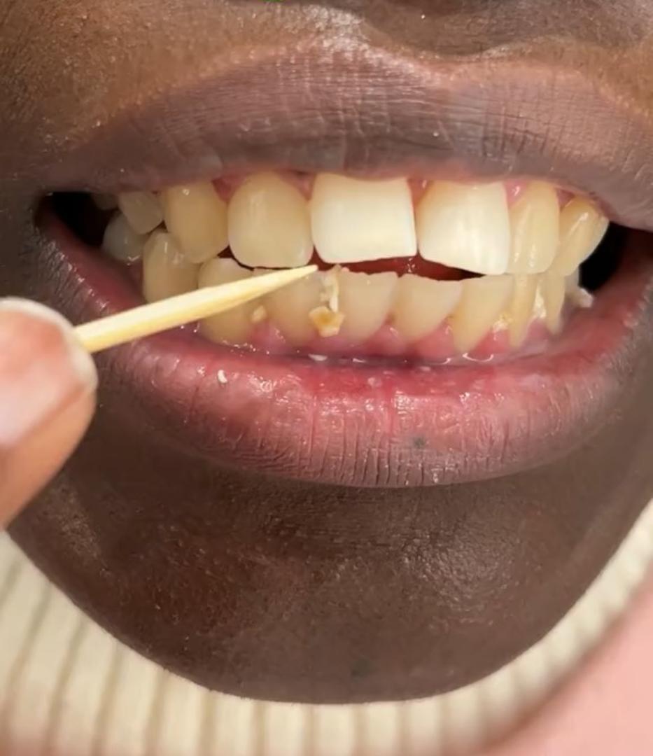 Dentifrice Blancheur